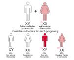 Congenitale X-linked: Man>>>vrouw 30% zijn nieuwe mutaties Incidentie: : 1/5.000 mannelijke geboortes FIX: 1/30.