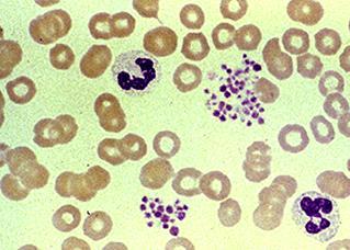 Aggregatie van in vitro Geen bloedingsneiging Veroorzaakt door natuurlijke autoantistoffen tegen -antigenen die