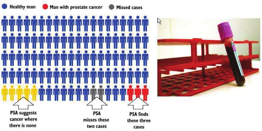 prostaatkanker ~ PSA screening screening nodig?