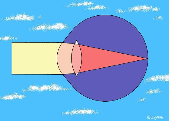 de achterzijde van het oog bekleden (figuur 1). Op deze wijze ontstaat een correcte breking of refractie van het licht.