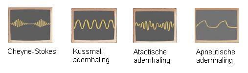 Observatie respiratie Bij de patiënt met neurologische problemen en een verminderd bewustzijn is het belangrijk altijd de ademweg te waarborgen en te zorgen voor een goede oxygenatie om secundaire