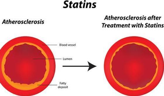 PERIFERE ARTERIOPATHIE: AANPAK Medicatie: