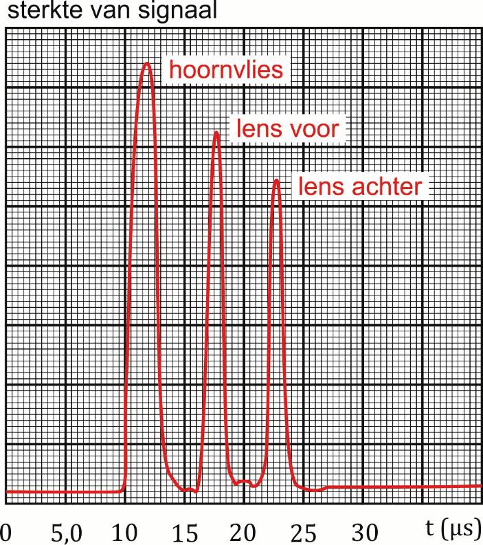 Uit de tijd die verstrijkt tussen het uitzenden van de puls en het ontvangen van de echo wordt de afstand bepaald tussen het grensoppervlak waaraan de geluidspuls is weerkaatst en de transducer.