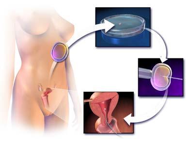 Definitie van subfertiliteit Voorwaarden voor menselijke vruchtbaarheid Oorzaken van subfertiliteit Belang van demografische en