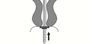 Terwijl de schuiver constant naar beneden wordt gehouden, trekt u de inserter voorzichtig naar buiten. Knip de draden door op ongeveer 2-3 cm afstand van de portio. figuur 7 BELANGRIJK!