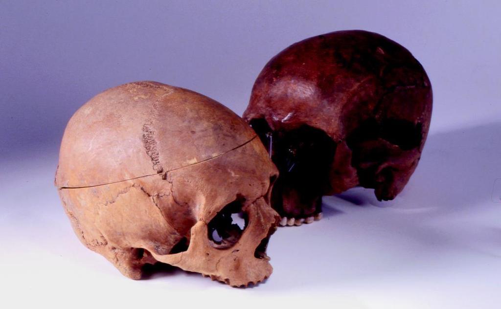 De schedels uit de Koenesteeg. De horizontale lijn op de voorste schedel is een zaagsnede die moderne onderzoekers hebben gezet om de binnenkant van de schedel te kunnen bekijken.