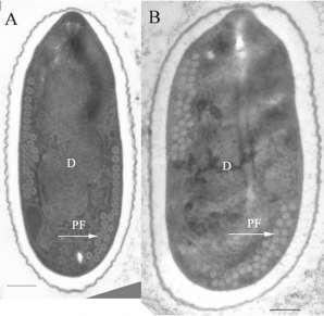 Nosema spp.