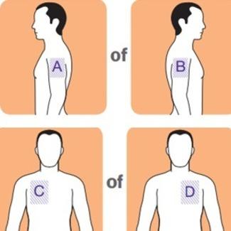 Als u dagelijks crème, (body)lotion, olie of poeder gebruikt, kan dit worden aangebracht na het opplakken van de pleister.