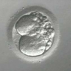 Embryo ontwikkeling dag 1