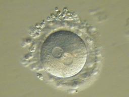IJkpunten tijdens de laboratoriumfase van de IVF behandeling Normaal bevruchte eicellen (dag 1 na bevruchting) Beste embryo(