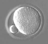 ingevroren embryo s: - Geen