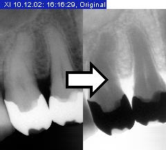 3 Bediening Sirona Dental Systems GmbH 3.7 Analysehulpmiddelen De actie kan ongedaan worden gemaakt door opnieuw oproepen.