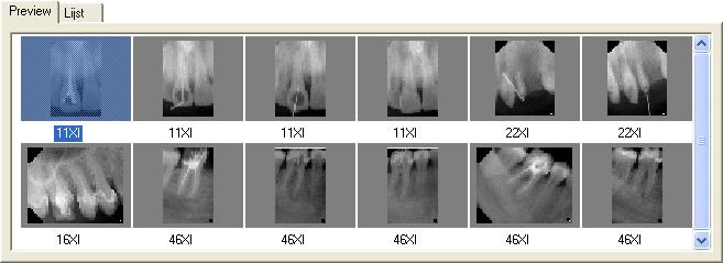 bewerkingsstware (GALAXIS) op de geselecteerde GALILEOSopname. 3.5.3.2 Enkelvoudige selectie Voorbeeldschermen Bij de enkelvoudige selectie wordt er telkens slechts één beeld geselecteerd.