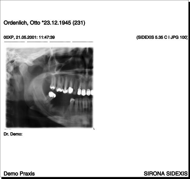 3 Bediening Sirona Dental Systems GmbH 3.5 Fotobeheer Bij het afdrukken wordt de tekst buiten het beeld afgebeeld, echter alleen bij het afdrukken van afzonderlijke beelden.