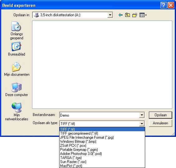 3 Bediening Sirona Dental Systems GmbH 3.5 Fotobeheer Voorbeeld-dialoog 1. De geformatteerde diskette in station A: leggen 2. Invoer in het tekstveld "Nom du fichier :" is "Tausch.tif" 3.