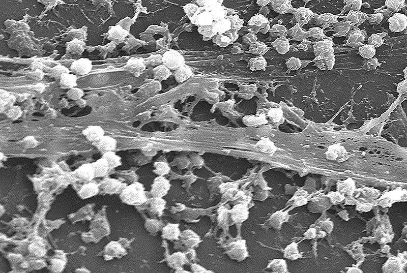 Biofilm Beschermen bacteriën tegen biociden, antibiotica en immuunsysteem Biofilms