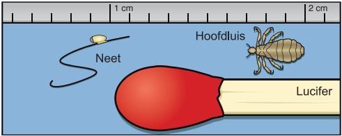 Pagina 3 Uw kind zichtbaar op Luizen Controleren Als u controleert op hoofdluis, kijk dan goed tussen de haren. Vooral in de haren achter de oren en in de nek.