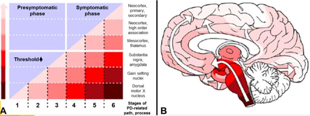 Symptomatologie bij de ziekte van Parkinson Motorisch bradykinesie, rigiditeit, rusttremor balansstoornissen, houdingsveranderingen, dysarthrie, Cognitief/gedragsmatig depressie, bradyfrenie,