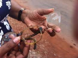 Begrippen: letsel (opmerking) 15 Een bril, contactlenzen, gebit, gehoorapparaat en dergelijke worden beschouwd als een prothese als zij bestendig gedragen worden door het personeelslid en
