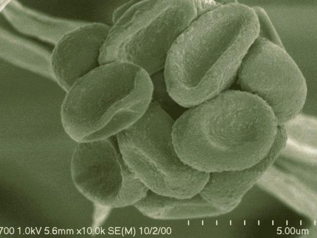 Trichoderma Antagonisten tegen