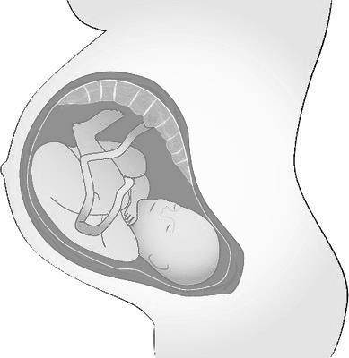 Foetale en Neonatale Alloimmuun Trombocytopenie (FNAIT) Alloimmunisatie Human