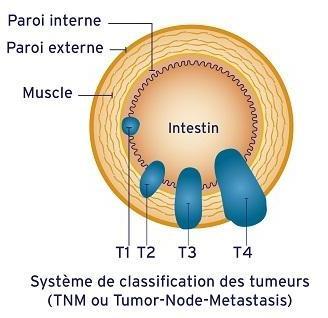 Interne wand Externe wand Spier Darm