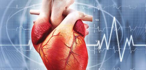 Het hart is in vier kamers verdeeld: Een hartaanval ontstaat door een vernauwing of blokkering van de kransslagaders die bloed naar het hart toevoeren.
