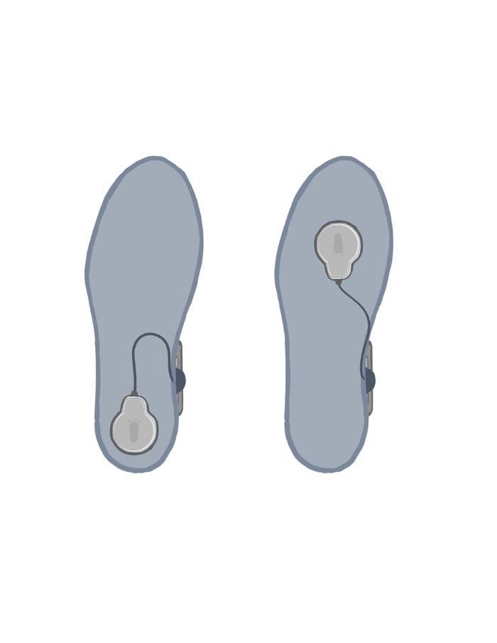De plaatsing van de voetsensor kan worden aangepast op basis van het eerste contactpunt van de patiënt. Voor het merendeel van de patiënten moet de voetsensor bij de hiel worden geplaatst.