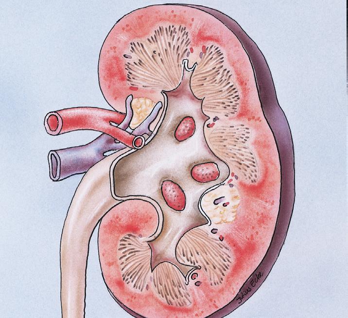 Wat is een urostoma Het urinestelsel Urine wordt afgevoerd vanuit de beide nieren via de urineleiders, de blaas en de urethra of urinebuis.