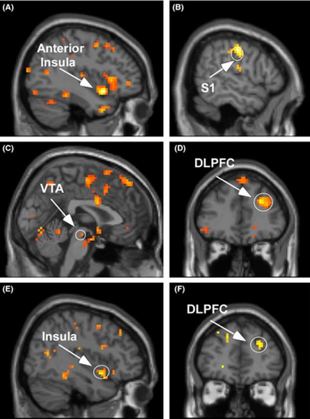 HOOGGEVOELIGHEID (H)ERKENNEN Diepgaande verwerking, zichtbaar in het brein Dat de hersenen van HSP ers onder de fmri-scanner bij een bepaalde opdracht in meer gebieden oplichten dan die van de