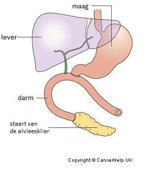 De dunne darm wordt gebruikt om een nieuwe verbinding te maken tussen maag, alvleesklier, galwegen en darmen.