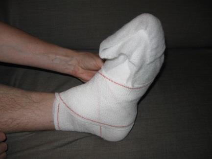 Doorgaans wordt na de wondorg een beschermend verband rond de voet aangebracht. De dikte van het verband hangt af van de manier van drukontlasting die wordt gebruikt.