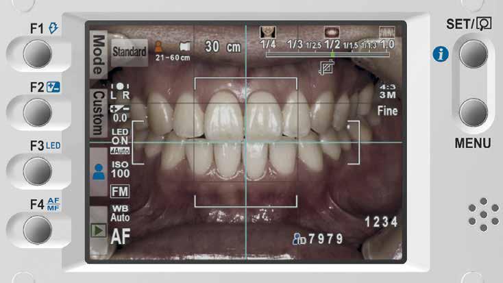 Afb. 3: De EyeSpecial C-III is intuïtief te bedienen en beschikt over acht motiefprogramma s, speciaal voor dentale toepassingen.