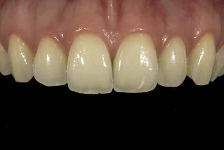 Met deze vier foto s krijgt de tandtechnicus uitgebreide informatie die hij anders alleen zou krijgen als hij de patiënt persoonlijk zou ontmoeten.