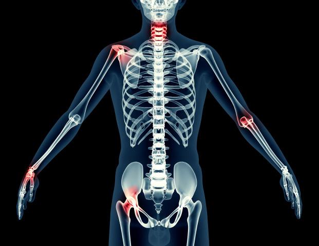 april 2017 hoofdverpleegkundige Nucleaire Geneeskunde Botscintigrafie Bij een botscintigrafie (botscan of skeletscintigrafie) wordt de activiteit en dus de functie van de botcellen gemeten.