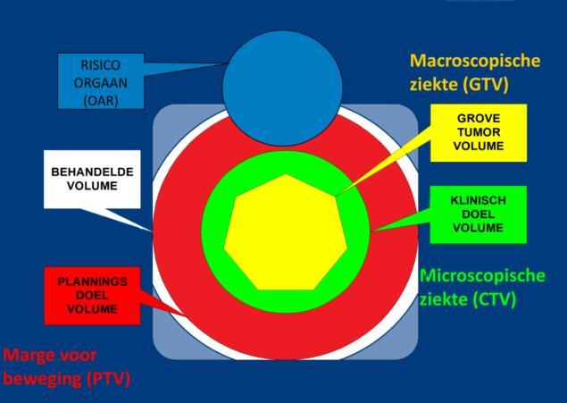 Brachytherapie Inwendige bestraling Voordeel Applicator dicht op tumor (geen PTV) Stijler dosis afval Hoge dosis tumor Lage dosis