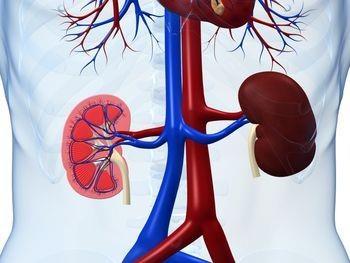 Renal cell carcinoma Nefectomie