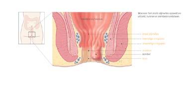 Afbeelding: Helder kliniek, www.helderkliniek.