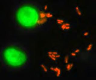 pneumophilamet Legionella pneumophila Niet geïnfecteerde protozo Protozo: