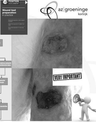 Wondrandbescherming V E R B A N D K E U Z E 10. Productkeuze 11. Bedekkend verband 12. Fixatie 13.