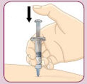 4g Zorg ervoor dat u de injectietechniek gebruikt die u is aanbevolen door uw arts of diabetesverpleegkundige. Denk eraan: U moet uw injectie Bydureon meteen na het mengen gebruiken.