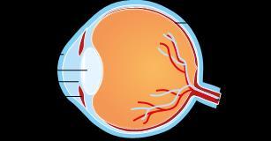 Staar, ook wel cataract geheten, is een vertroebeling van de ooglens. Deze lens is opgehangen midden in het oog achter de pupilopening.