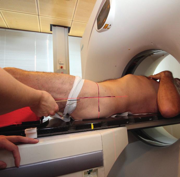 CT-scan en CT-PET scan De voorbereiding van de bestraling begint met een CT-scan en/of een CT-PET-scan CT betekent Computer Tomografie en PET betekent Positron Emissie Tomografie De CT-scanner is een