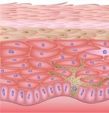 Keratinocyten geven de epidermis structuur Ontstaan na celdeling in het Stratum Basale, schuiven op naar boven