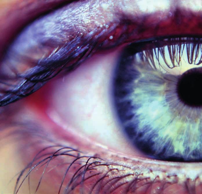 Met goede voorlichting kunnen we ervoor zorgen dat mensen een oogziekte in een vroeg stadium herkennen.