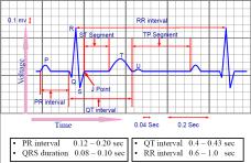 27/3/218 Enkele parameters FEF 25% FEF 5% FEF 75% Forced Expiratory x%: Enkele parameters: Tiffenau index het