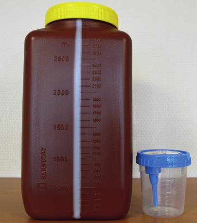 Inleiding Uw behandelend arts heeft u gevraagd 24-uurs urine te verzamelen om het gehalte 5-HIAA in de urine te bepalen.