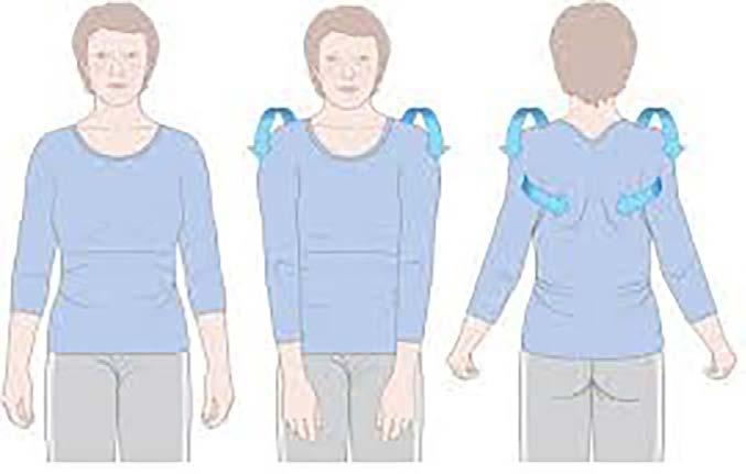 Algemene oefeningen voor thuis Schouderimmobilizer Scapulasetting en schouderelevatie