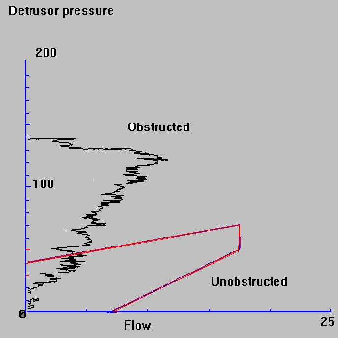 Pressure Flow