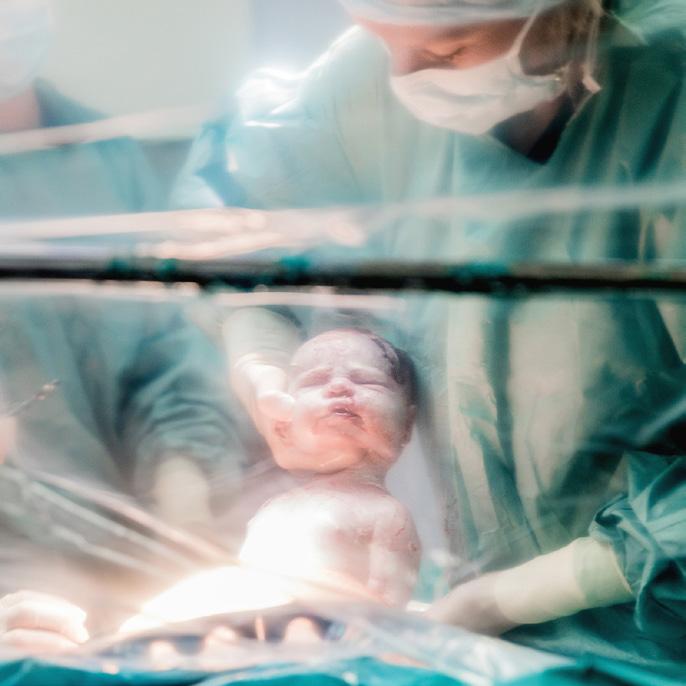Eenmaal de gynaecoloog aan de ingreep begint is de baby meestal binnen de 10 minuten geboren. Er wordt gewerkt met een afdekdoek met doorzichtig venster dat wordt geopend als de baby uit de buik komt.